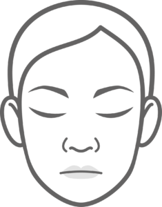 235x300 v shaped chin face augmentation with fillers scinn