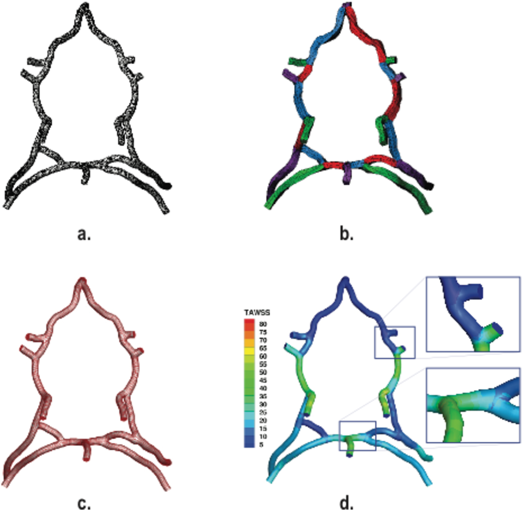 1018x994 figure from review of patient specific vascular modeling