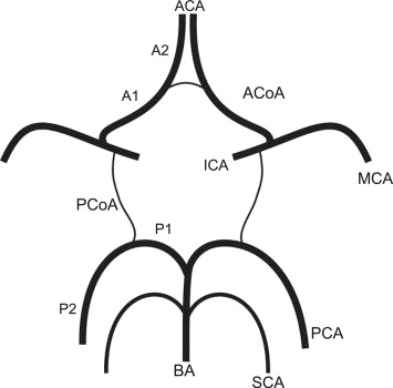 355x350 Non Invasive Visualization Of Collateral Blood Flow Patterns