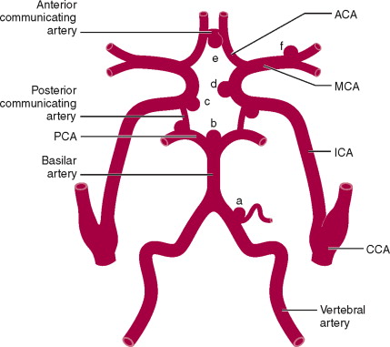 429x381 Recurrent Artery Of Heubner