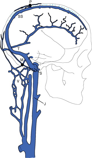 Circle Of Willis Drawing | Free download on ClipArtMag