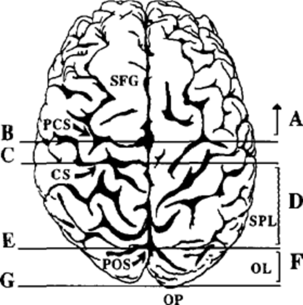 1020x1024 variability of the territories of the major cerebral arteries