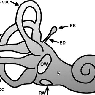320x320 drawing shows a common cavity formed