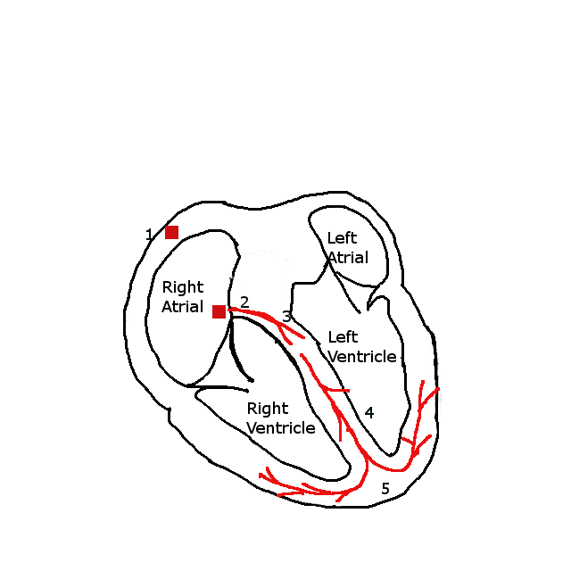 640x640 study guide conduction of the heart the novel nurse