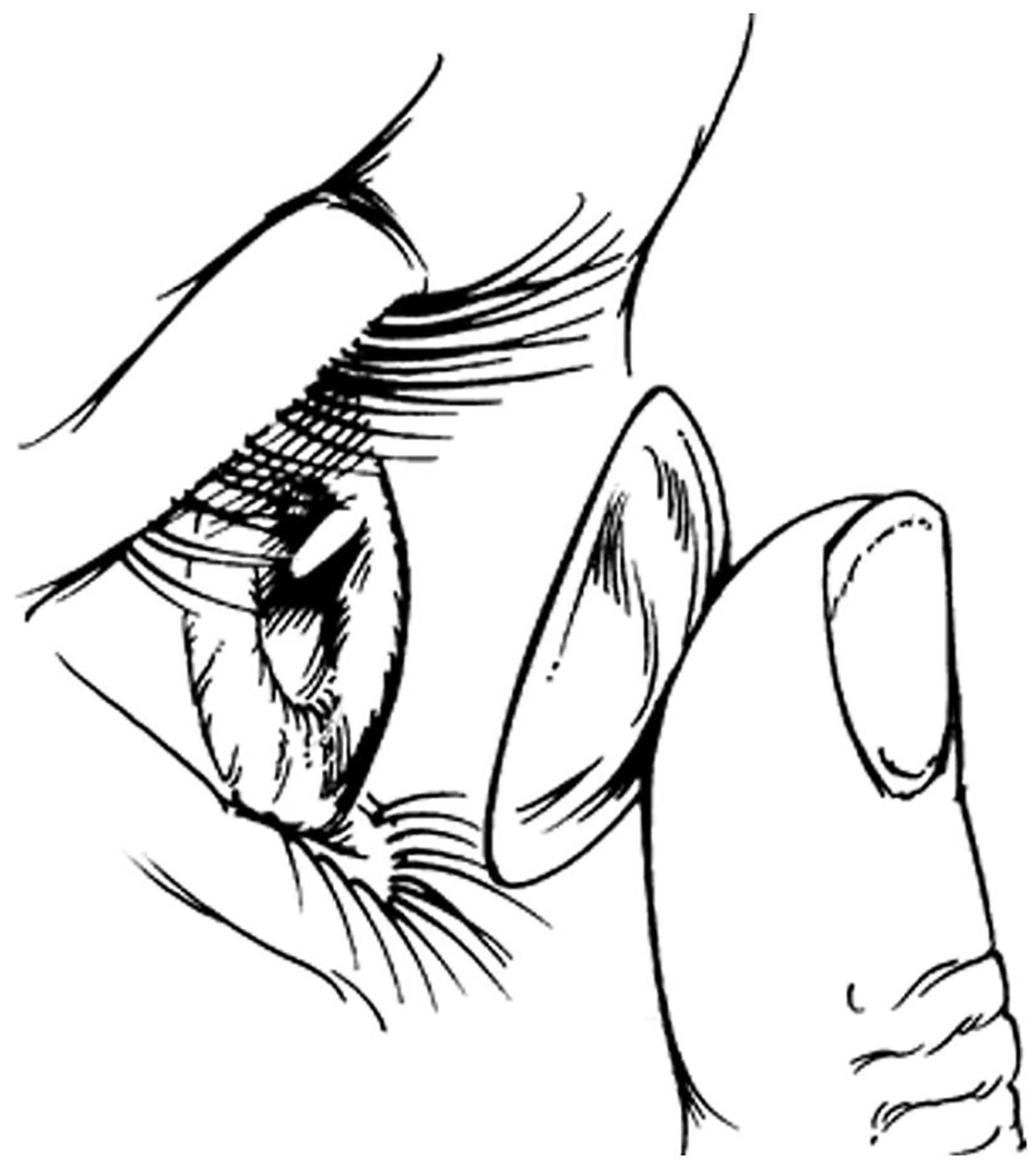 1708x1924 Huge Collection Of 'contact Lenses Drawing' Download More Than