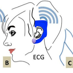 254x254 State Of Art Wearable Poc Devices Schematic