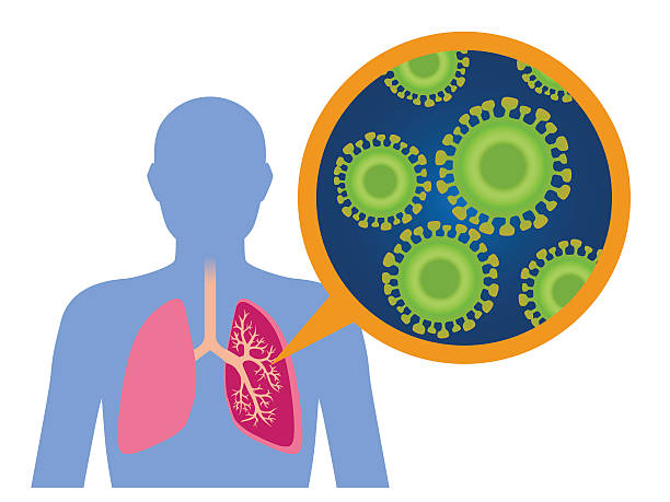 612x459 Coronavirus Clipart