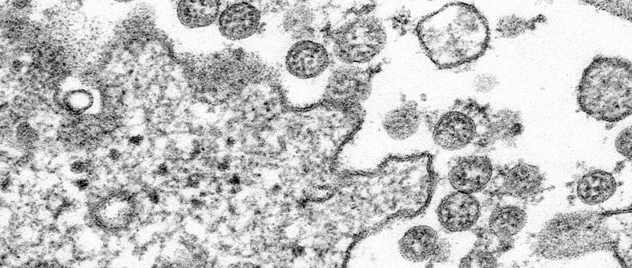 897x380 Covid 19 Coronavirus Drawing