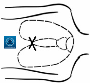 294x272 First Aid Drabc