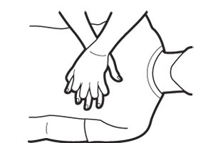 299x201 How To Perform Hands Only Cpr