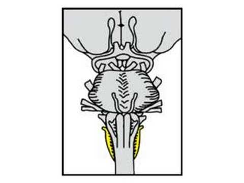 480x360 cranial nerve xi