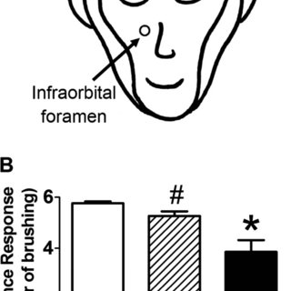 320x320 maxillary nerve compression in cynomolgus monkey and altered