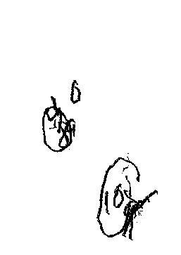 257x363 Clock Of Week September Concussion Assessment