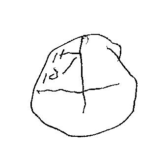 338x313 Dementia Concussion Assessment And Management Program