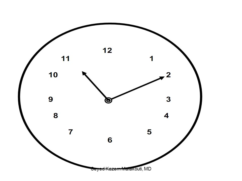 Dementia Clock Drawing Free download on ClipArtMag