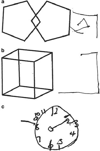 336x503 a novel, multidisciplinary clinic for complex visual problems