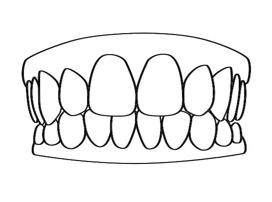556x414 partials dentures middlesex aesthetics dentistry
