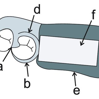 320x320 schematic drawing of removable partial dentures used in the study