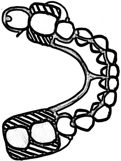 516x685 the importance of communication in the construction of partial