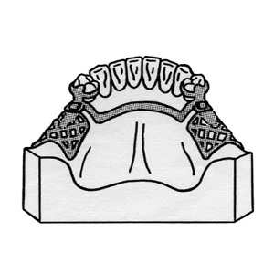 300x300 bio mechanical considerations in the use of hinges in partial