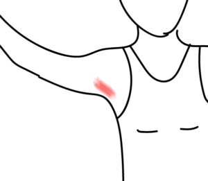 300x261 curing the itch from natural deodorant