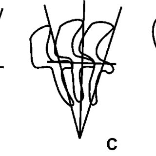 320x320 Diagrammatic Drawing Of The Denticles Of Trichodina Spp A T