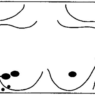 320x320 Disease Presentation