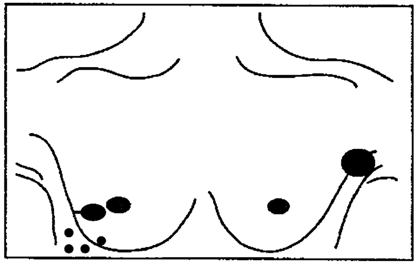 850x538 Disease Presentation