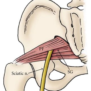 320x320 the drawing shows the proximal course the sciatic nerve passing