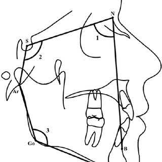 320x320 Polygon Of The Facial Profile Similarity' The Craniofacial Area