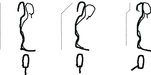 638x318 sketch of headrest configuration alternatives to correct