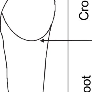 320x320 drawing of tooth and how crown root ratio was measured download