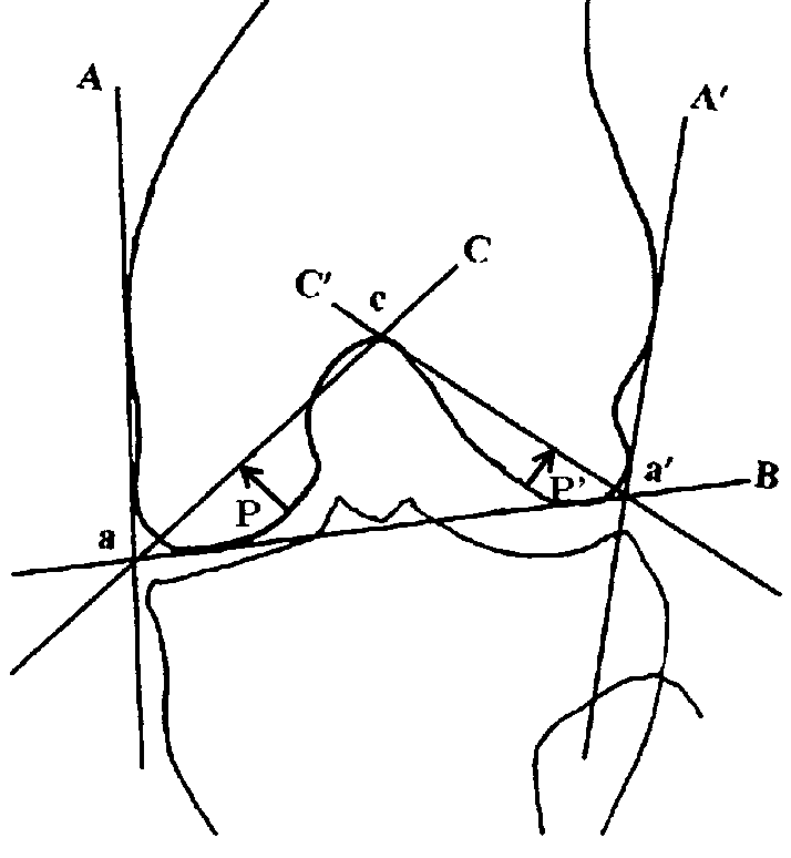 714x774 A Schematic Drawing Of The Measurement To Produce The Prominence
