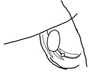 303x250 Lost Sight Of Lightning