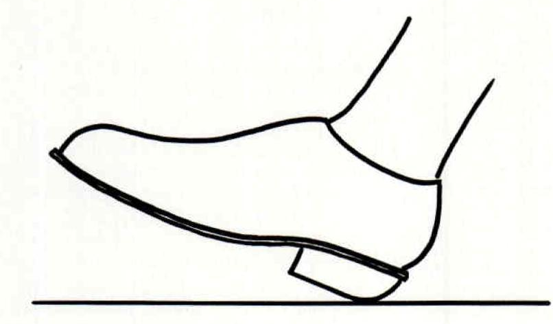 806x472 Figure From Studies Orthotic Management Of The Adult Post