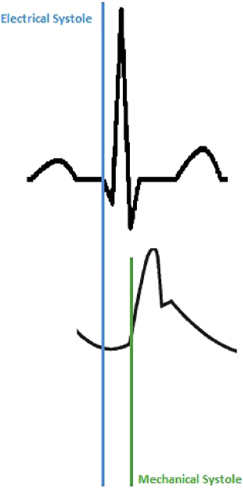 342x686 figure from arterial waveform analysis