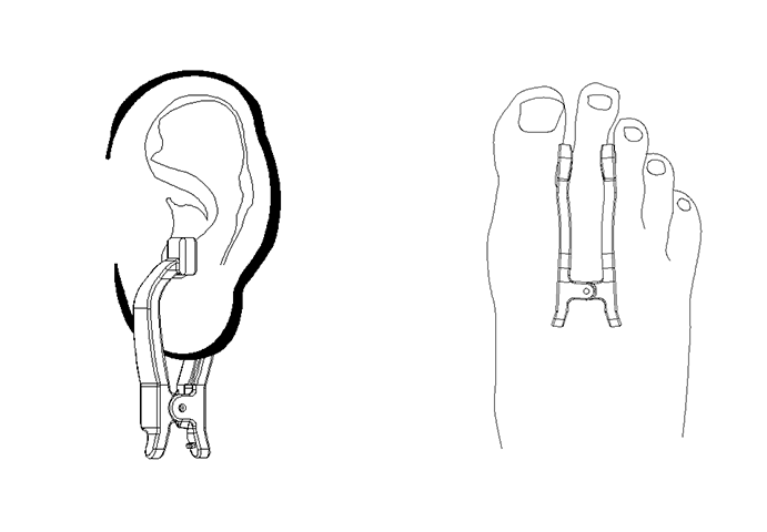 691x480 smart handheld blood pressure monitoring system goldcard smart