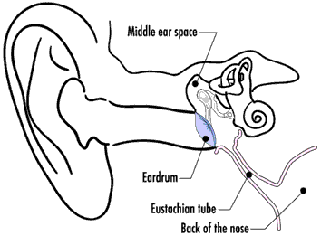 354x261 Ear Tubes Information Children's Education Materials