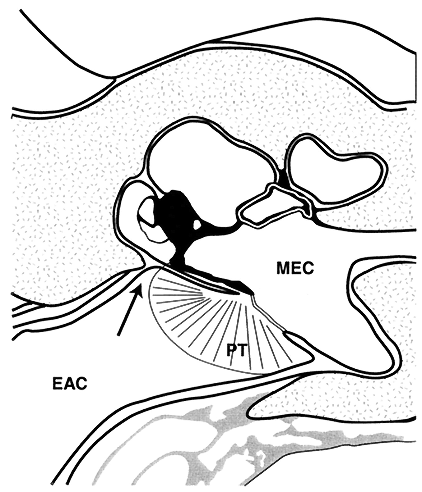 1357x1584 Human Defensin Mrna Is Transcribed In Tympanic Membrane