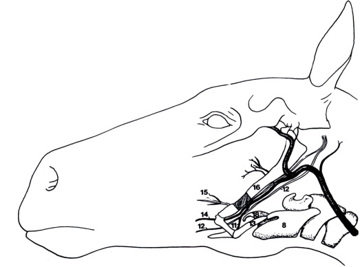 523x388 Otitis Media And Interna And Temporohyoid Osteoarthropathy