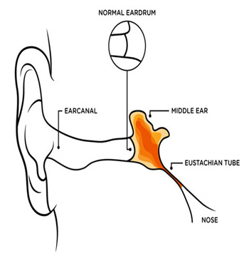 350x366 otovent natural pain relief for middle ear fluid, divers and air