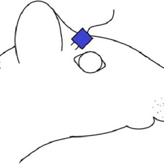 320x320 Simon I Angeli's Research Works Jackson Health System, Miami