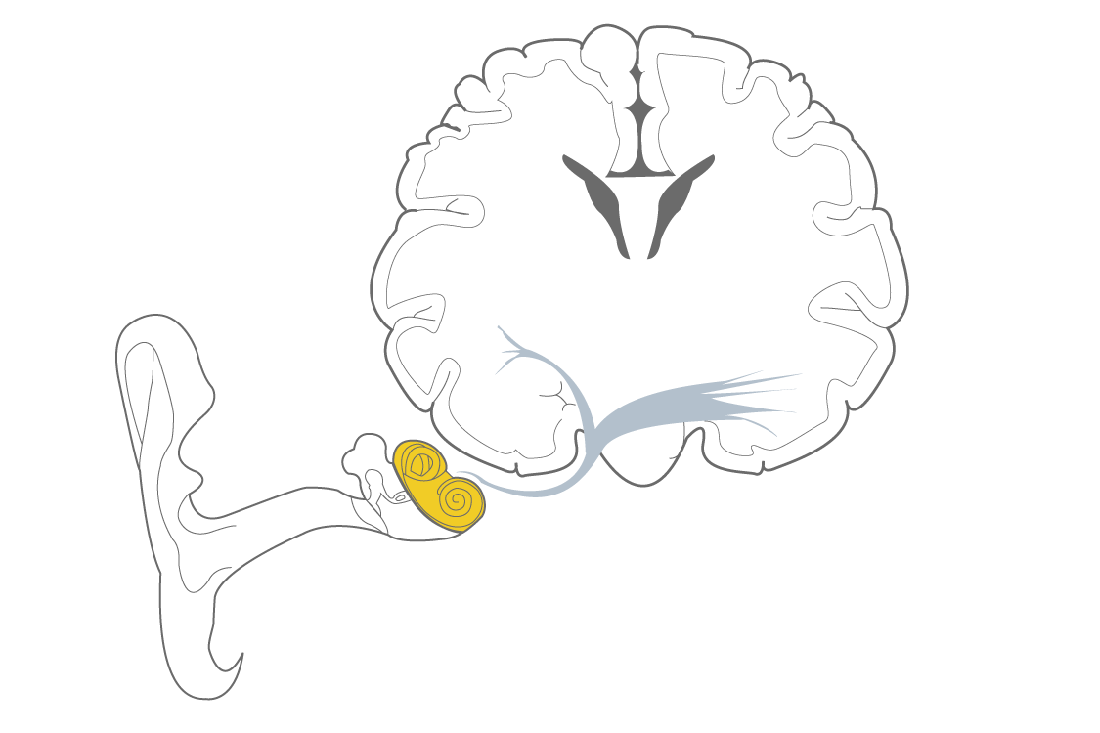 1100x733 Types Of Hearing Loss