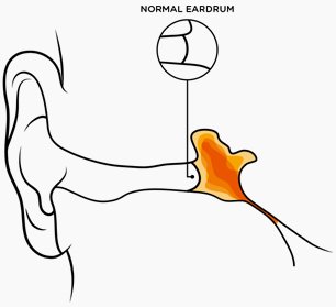 306x279 Normal Eardrum Otovent