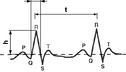 419x239 ecg components p wave, qrs complex, and t wave download