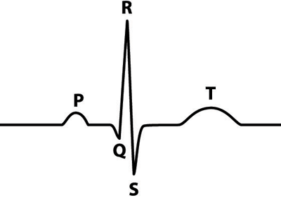 400x282 Ekg Waveform Lessons Drills