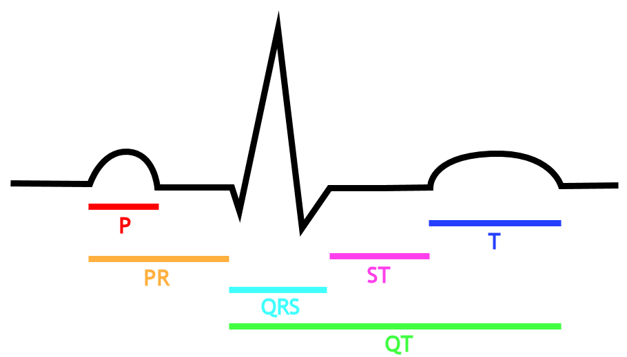 910x519 electrocardiogram