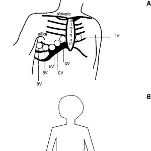300x300 lead ecg without rld ad studiogrfx