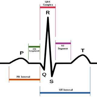 320x320 normal electrocardiogram