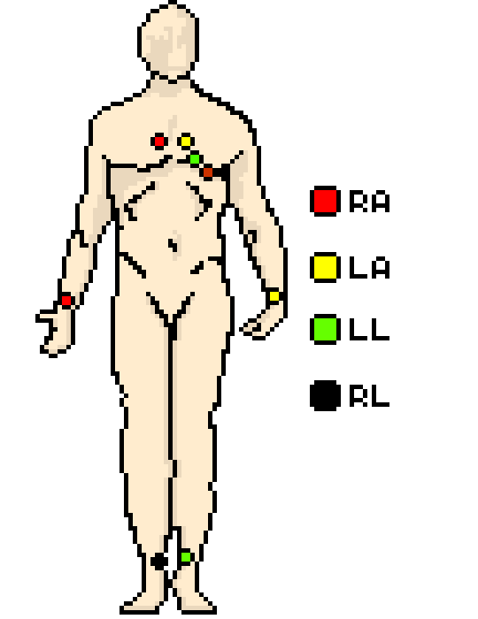 540x700 the ecg leads, polarity and einthoven's triangle the student